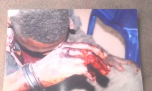 Nsikak writhing in pains after the attack