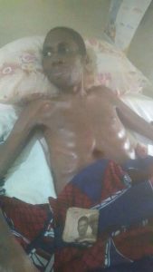 Wililiam lies bedridden at the Moniaya Hospital, Ogoja.